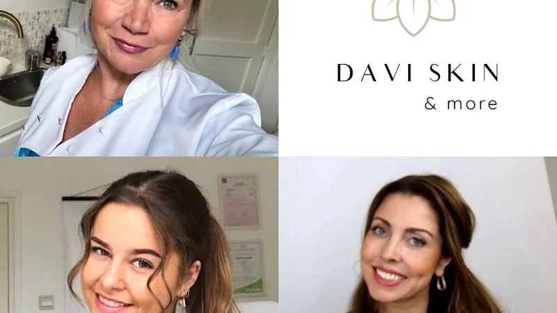 davi skin - Dordrecht