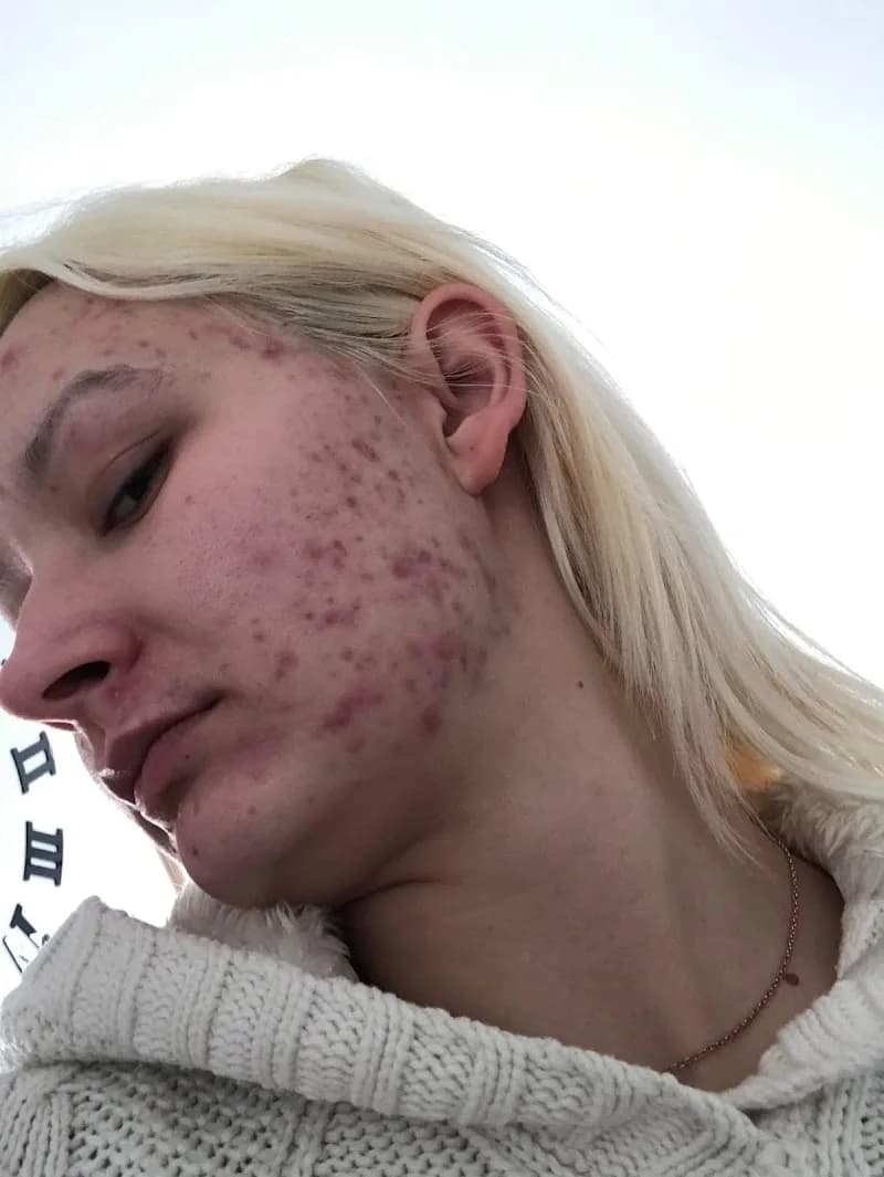 Foto van DermaBliss
