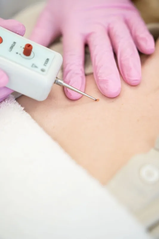 Foto van Huidkliniek de Vallei