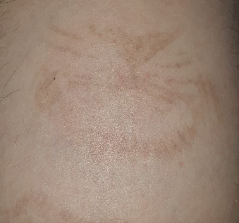 Laser Arie - Huizen