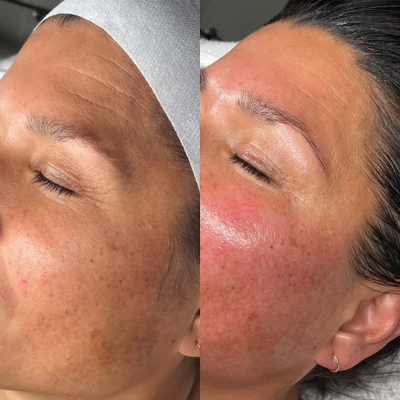 Lemmies Skin