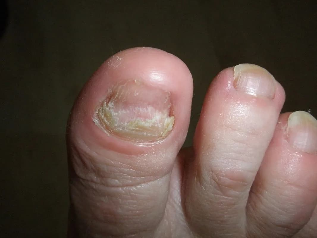 Pedicure Hillegom Footfit
