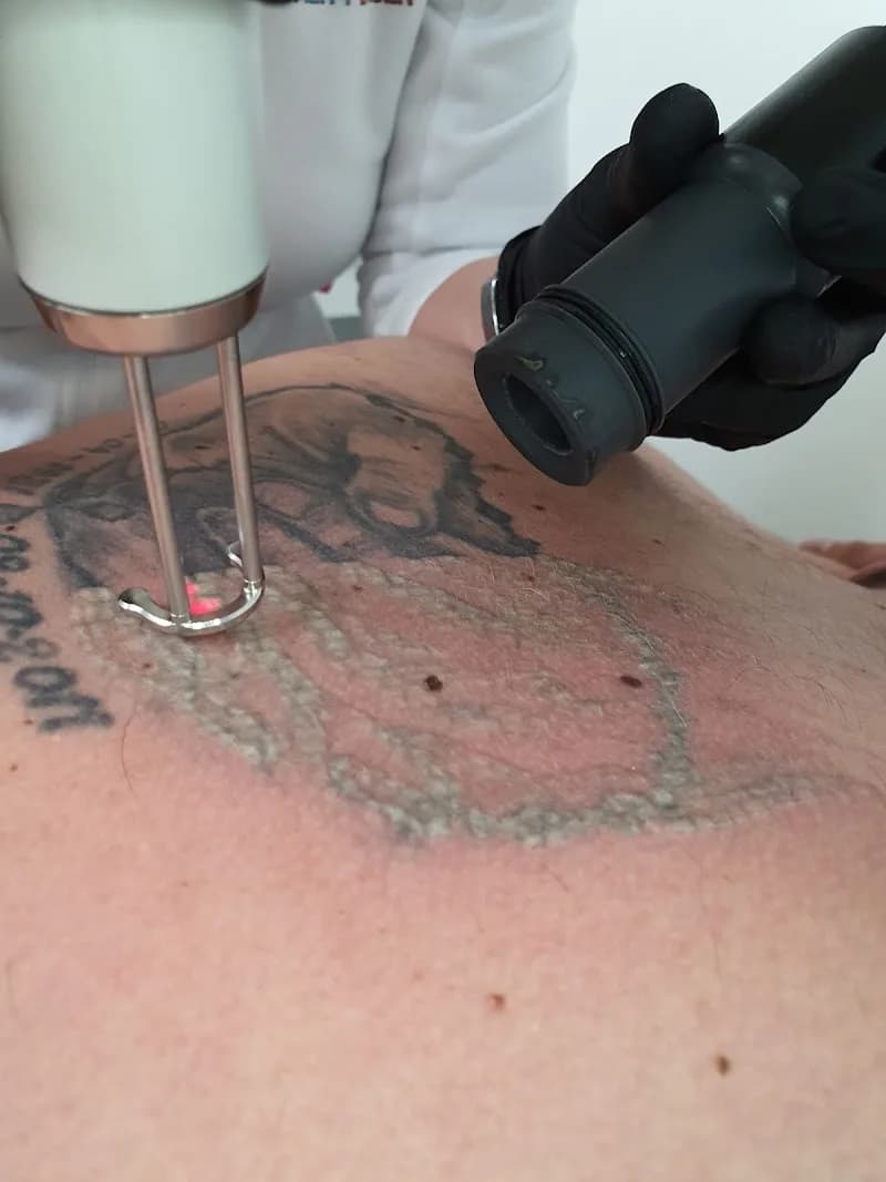 Quality Laser en Skin - Breda