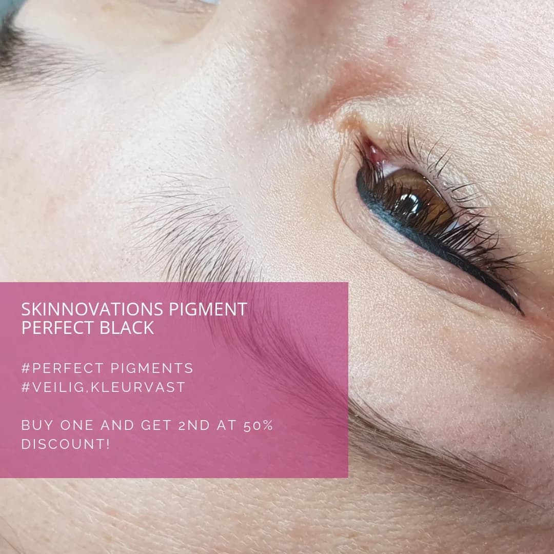Foto van SKINnovations
