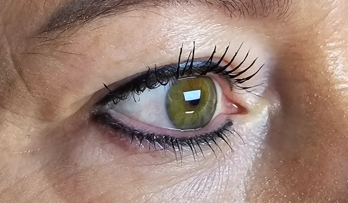 Skintouch