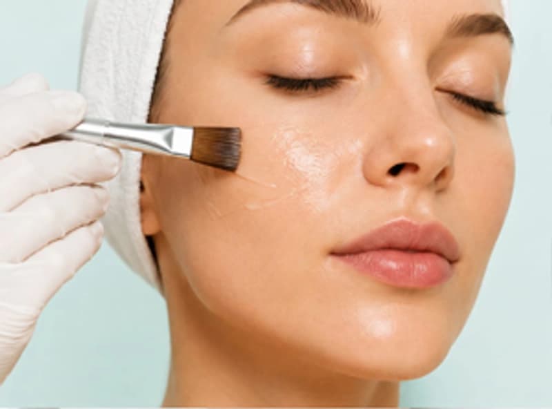 Chemische Peeling behandeling