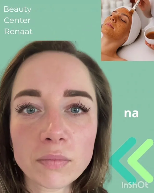 Foto van Beauty Center Renaat | Schoonheidssalon Ede