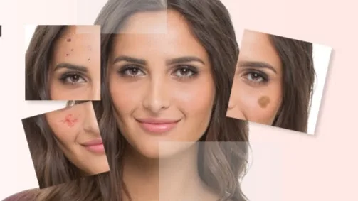Foto van BeautyDerm - Uw huid in balans