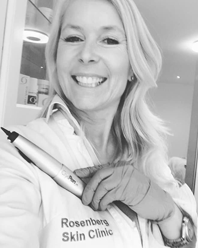 CryoPen® Specialist Rosenberg - Genital Wart & Skin Lesion Removal Amsterdam - Amsterdam