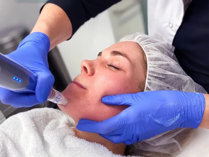 DermaVision - Berkel-Enschot