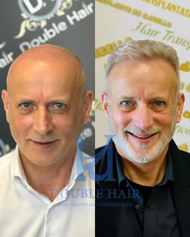 Foto van Double Hair Netherlands