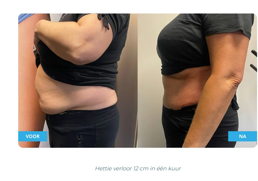 Fedine Beauty & Gezondheid HIFU | Laserontharing | Cryo Afslanken & Hypnotherapie