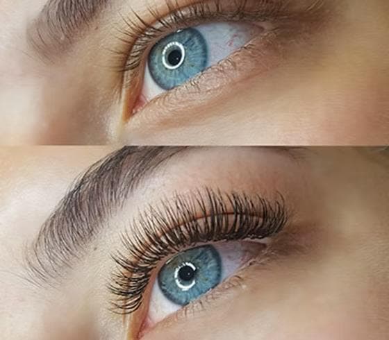 Full Beauty Clinics - Den Haag