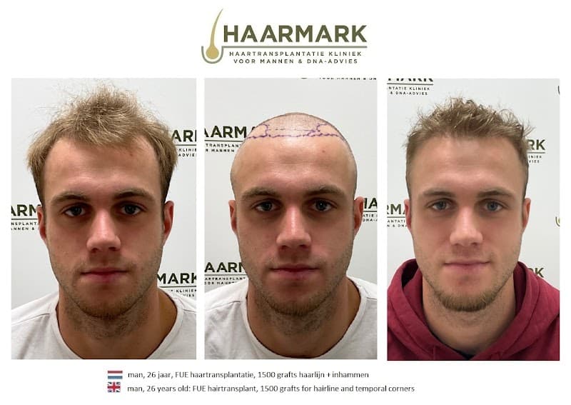 Haarmark haartransplantatie kliniek - Drachten