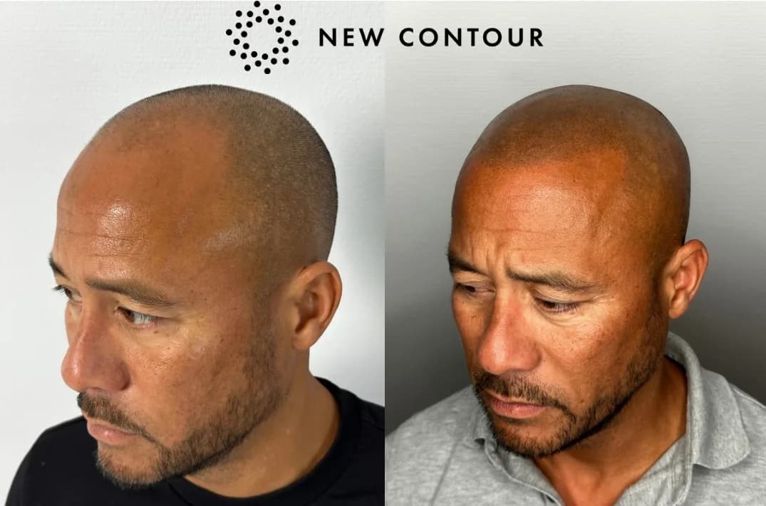 Foto van New Contour