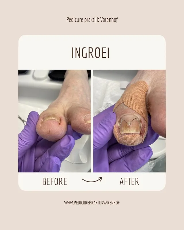 Pedicure praktijk Varenhof