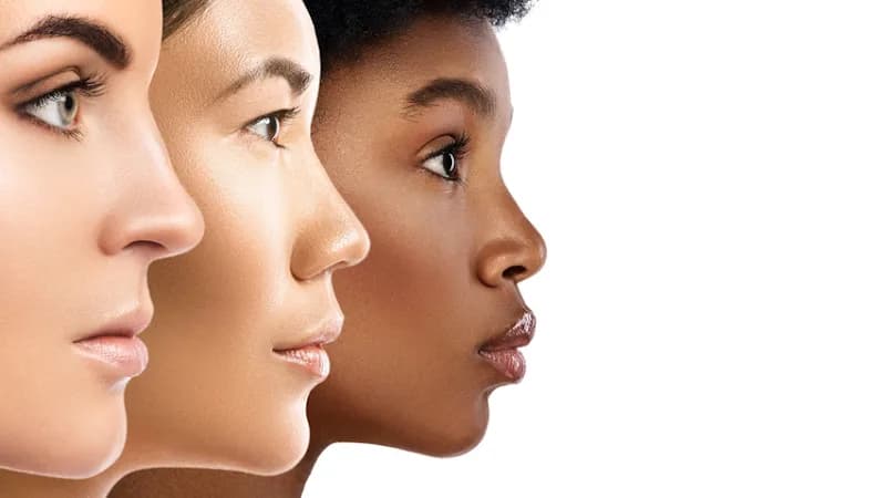 perfect skin balance - Apeldoorn