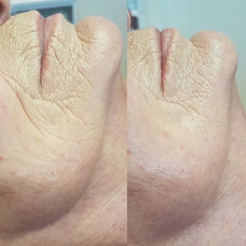 Schoonheidssalon Apeldoorn | Pedicure | Beautysalon Belissima - Apeldoorn