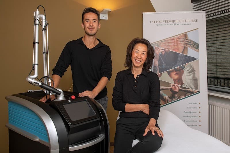 Tattoo Verwijderen Eindhoven - Eindhoven