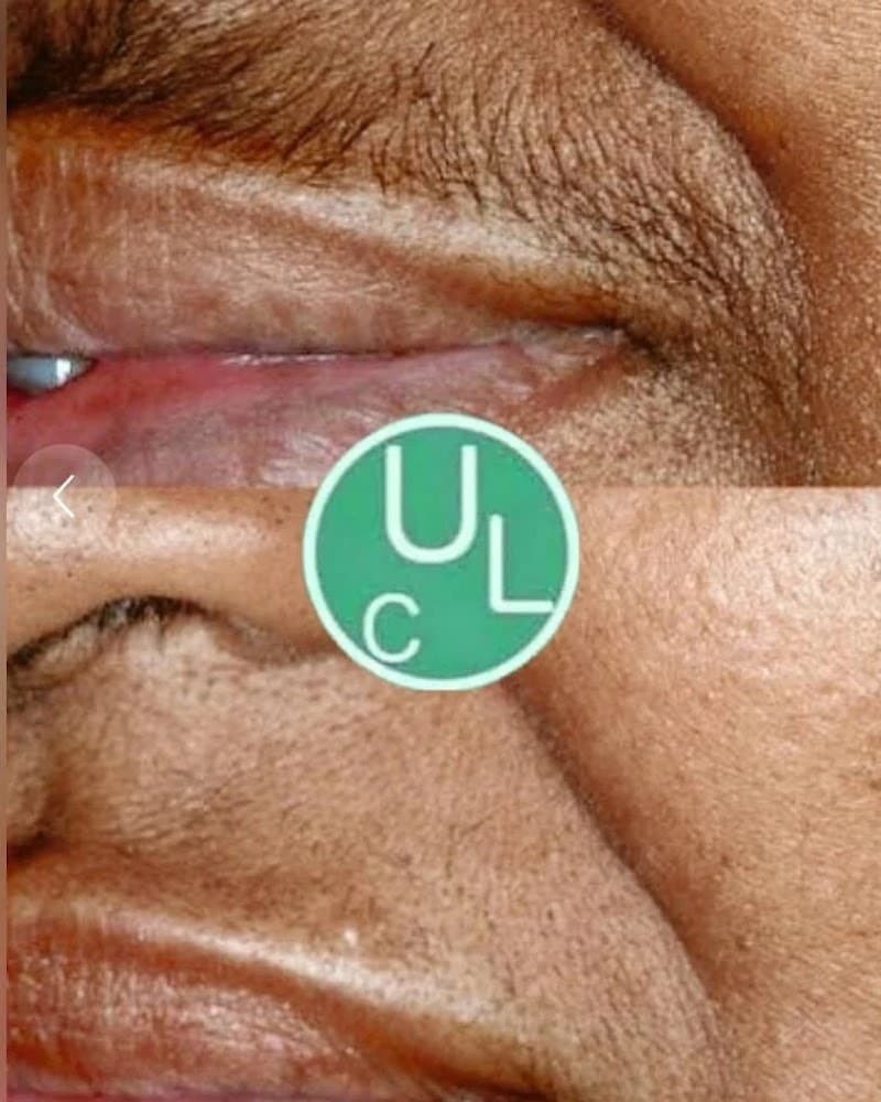 Uniek Laser Clinic - Breda